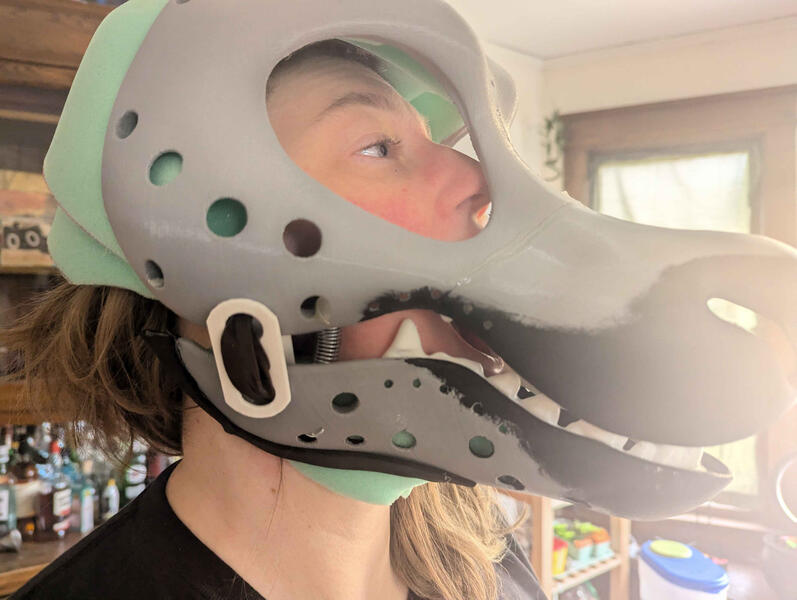 Failed Padding attempt 1: Limitation in Jaw movement (The poor alignment results in the head pulling down and limited/ineffective jaw response)